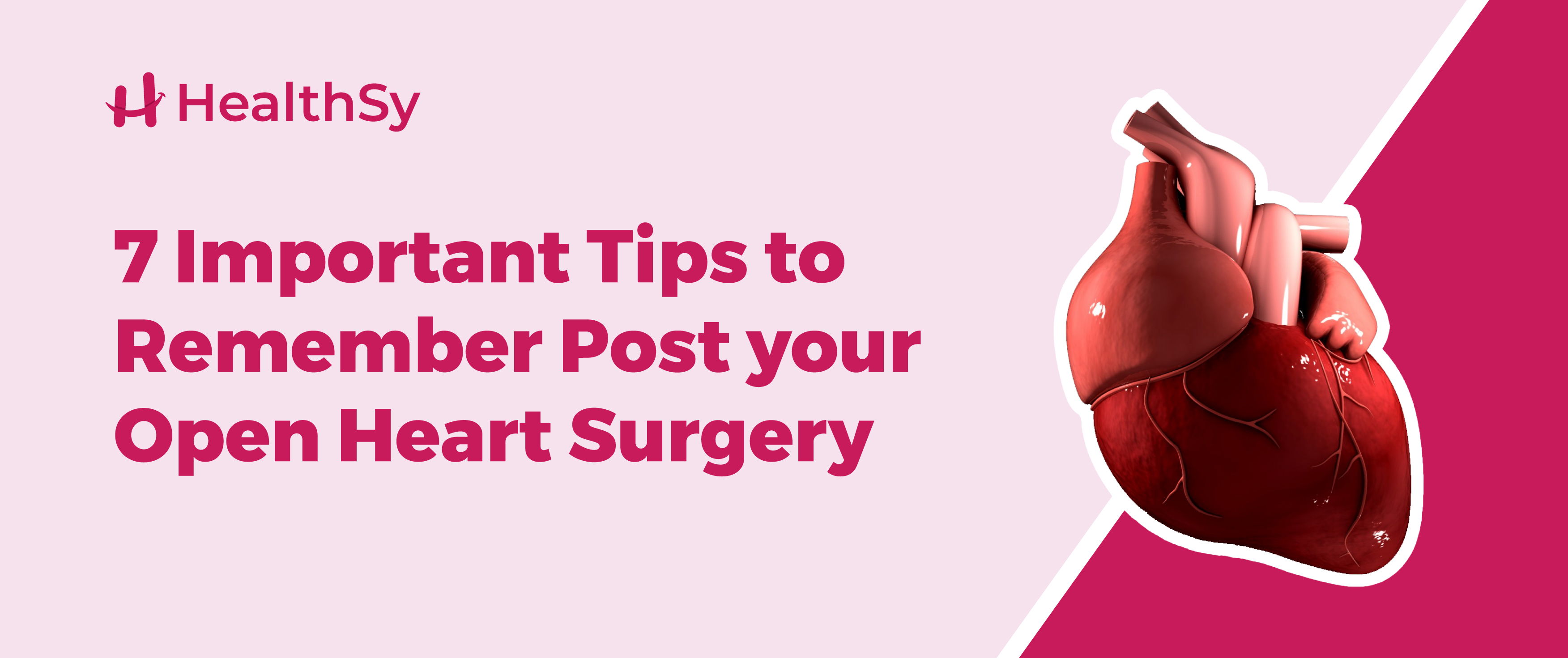 7 Important Tips to Remember Post your Open Heart Surgery